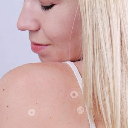 Invisible Anti-Acne Hydrocolloid Pimple Patches