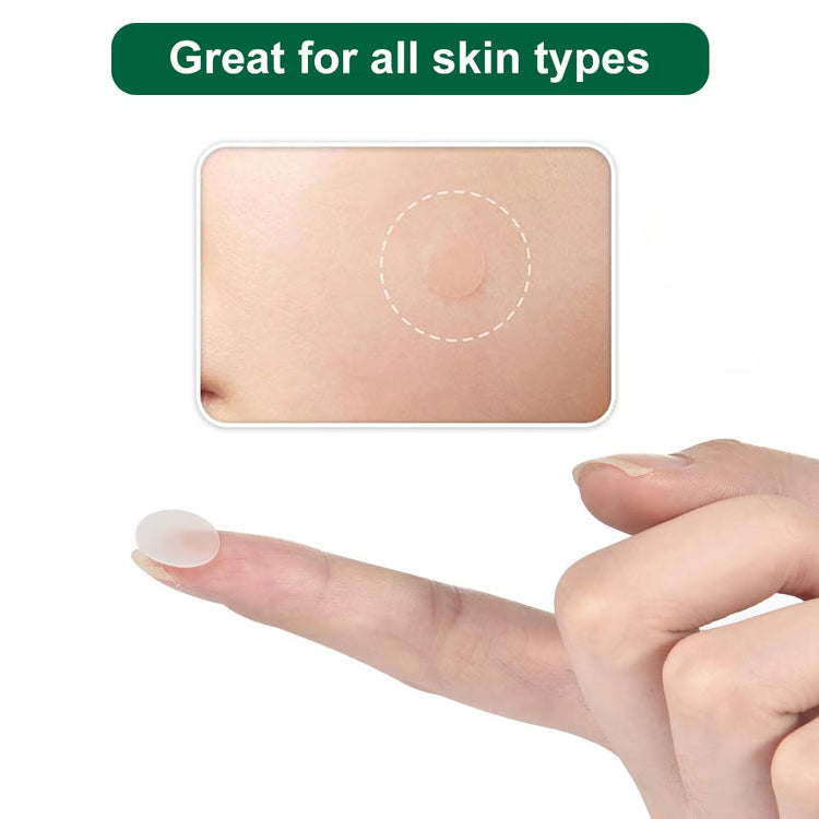 Invisible Anti-Acne Hydrocolloid Pimple Patches