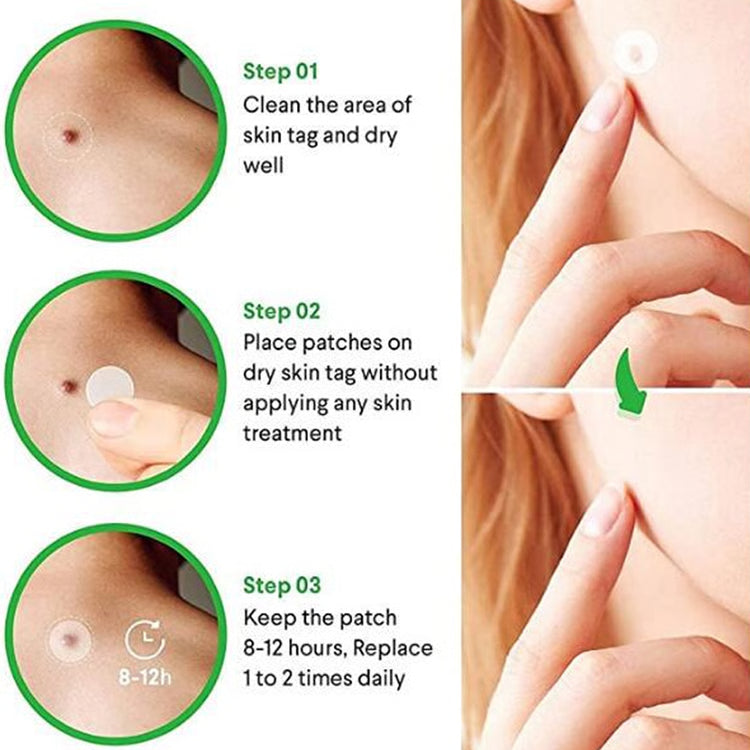 Invisible Anti-Acne Hydrocolloid Pimple Patches